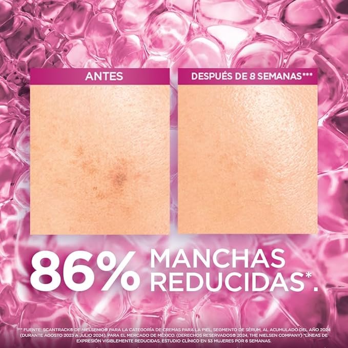 L'Oréal Paris Sérum facial antimanchas Glycolic Bright, 30ml - Suero facial con Acido Glicolico, Niacinamida y Melasyl que reduce todo tipo de manchas un 86%, para tu rutina de skin care